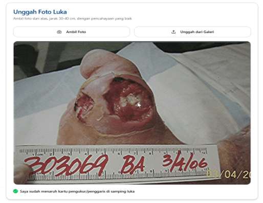 Derma-DFU | Diabetic Wound Analysis System