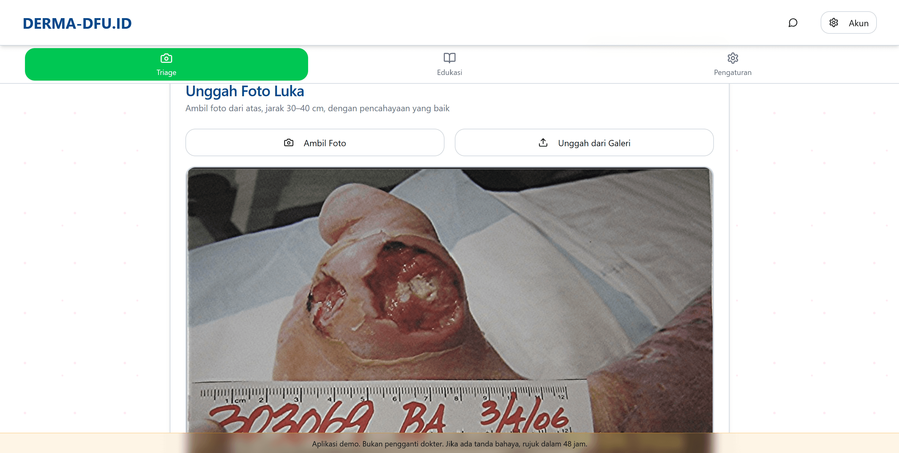 DERMA-DFU.ID | AI-Powered Diabetic Foot Ulcer Triage System